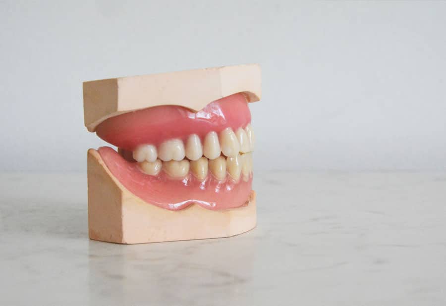 Teeth Grinding | Dental Treatment in Toowoomba