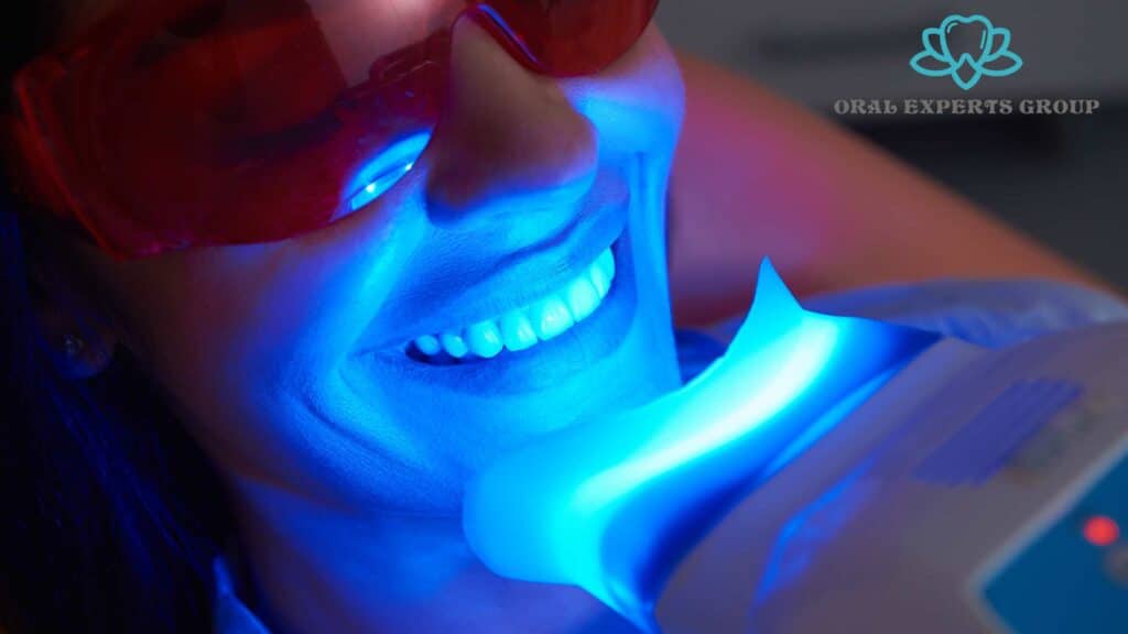 Laser Teeth Whitening