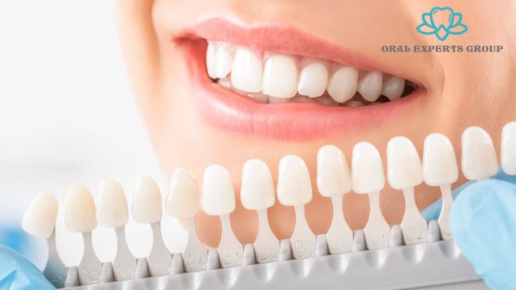 Whitening