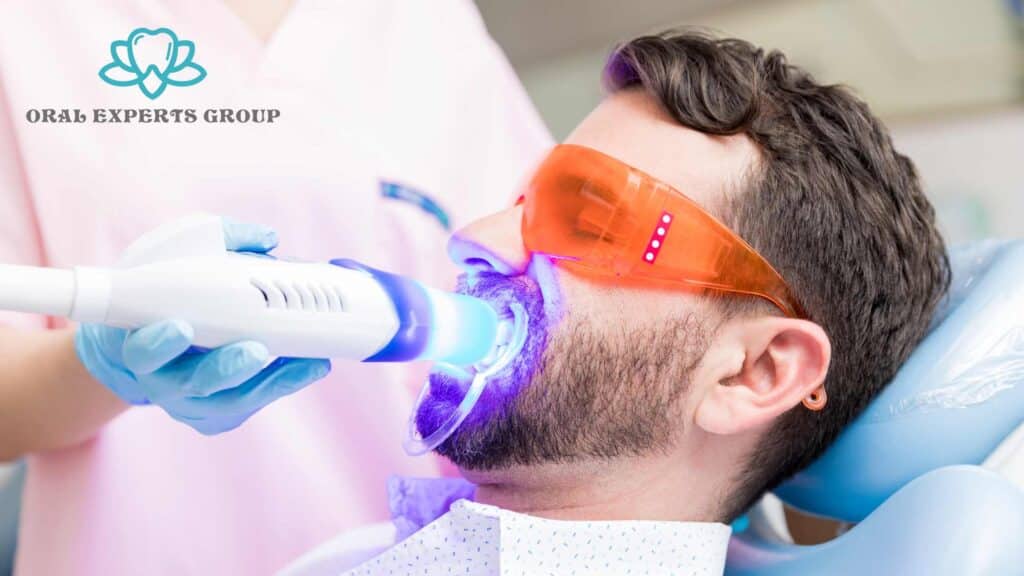 Laser Teeth Whitening