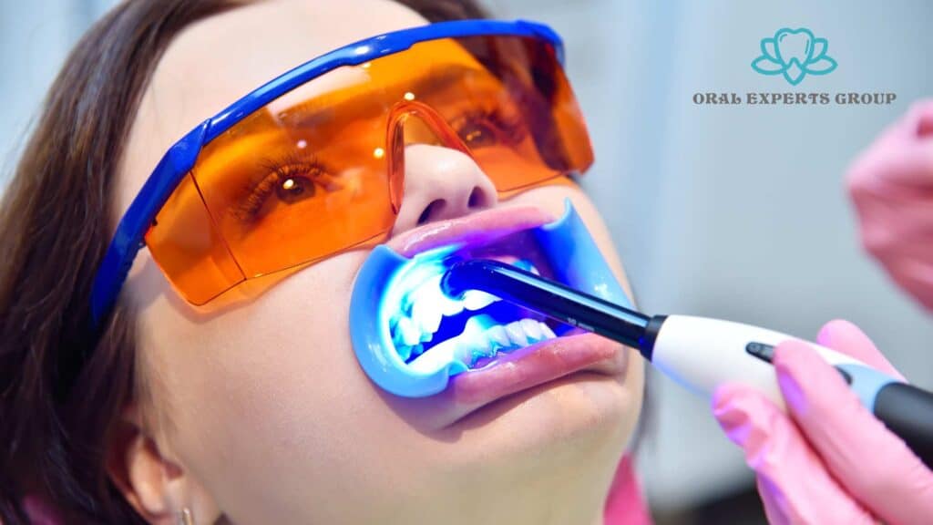 Dental Laser Whitening