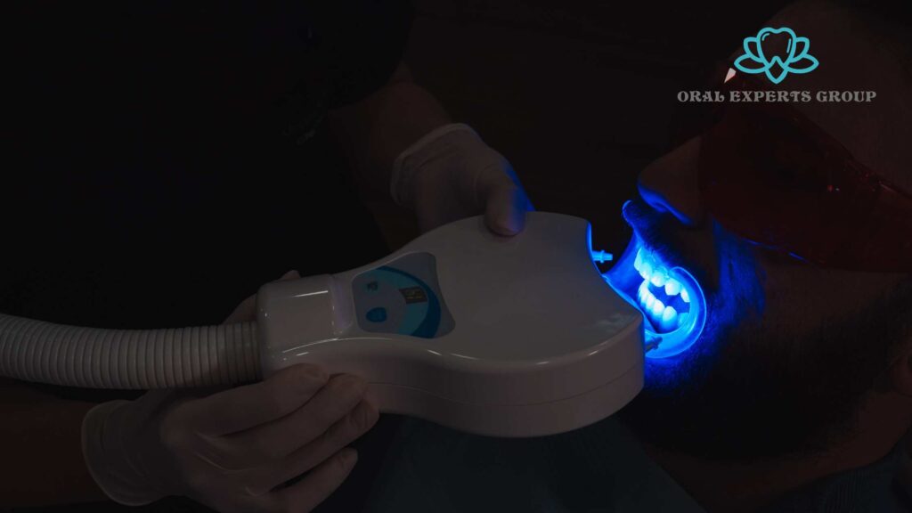 Dental Laser Whitening 