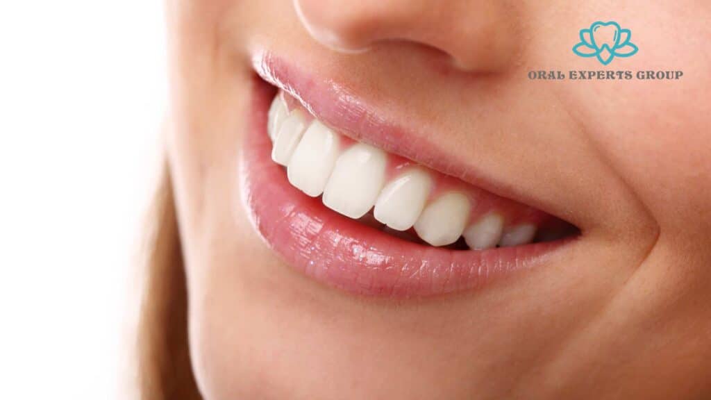 Dental Laser Whitening 