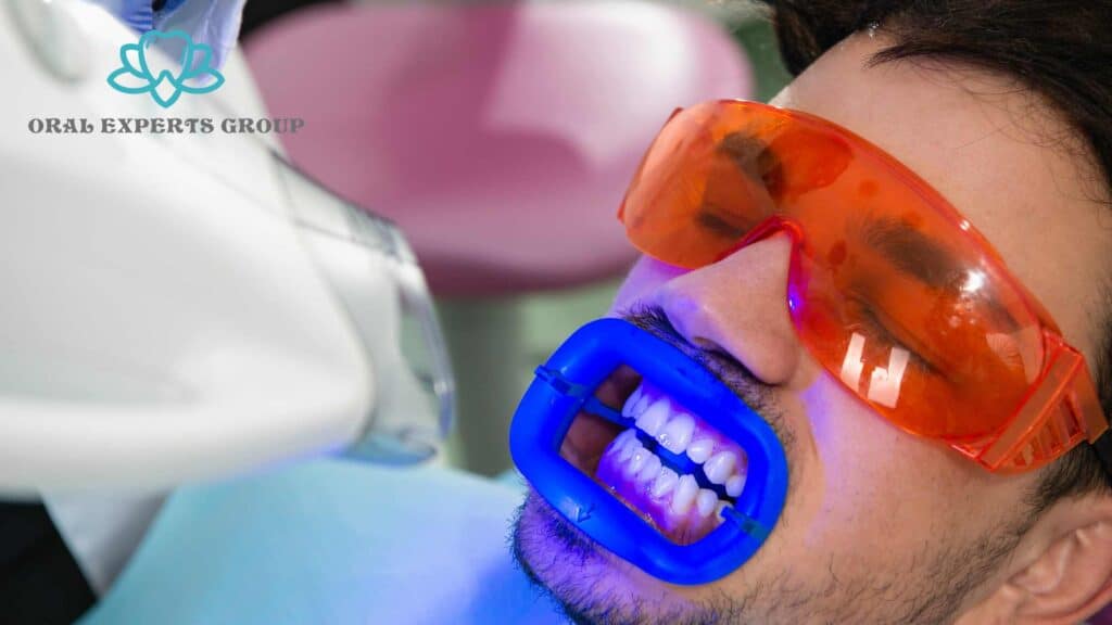 Laser Teeth Whitening