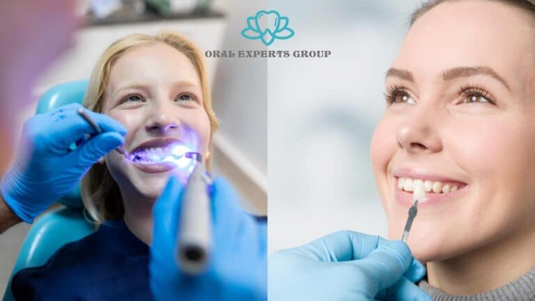 Teeth Whitening vs Dental Veneers