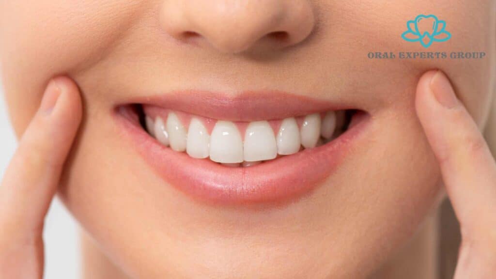 Teeth Whitening