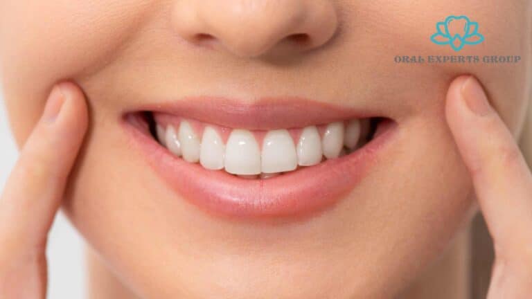 Teeth Whitening