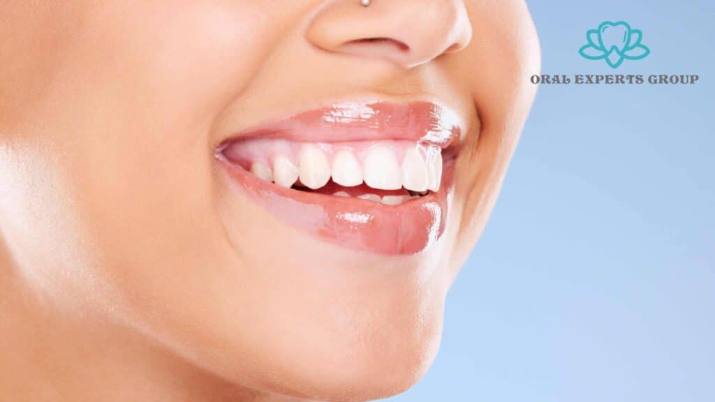 Teeth Whitening