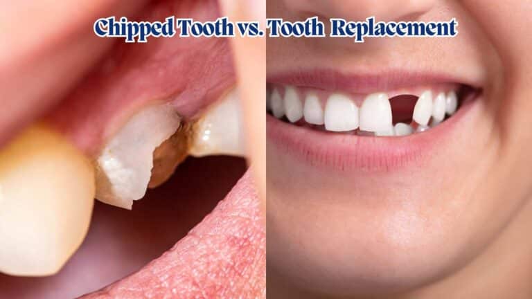 Chipped Tooth vs. Replacement