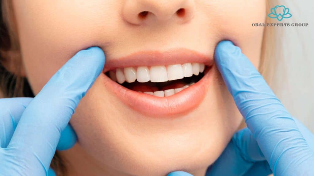 Tooth Whitening